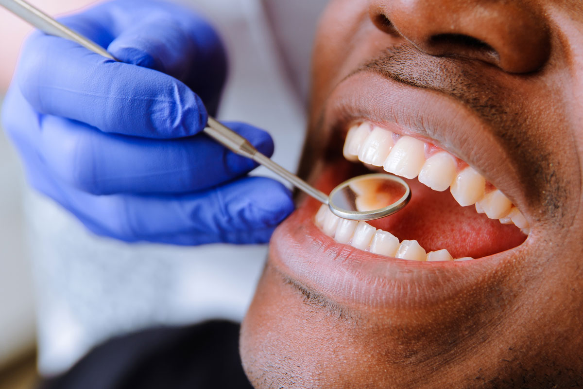 أسباب الخراج في الأسنان