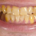 تفسير رؤية الأسنان الصفراء في المنام ومعناه بالتفصيل