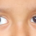 طرق علاج انحراف العين بالتمارين مجرب ومضمون